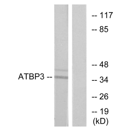 Western Blot - Anti-ATPBD3 Antibody (C11268) - Antibodies.com