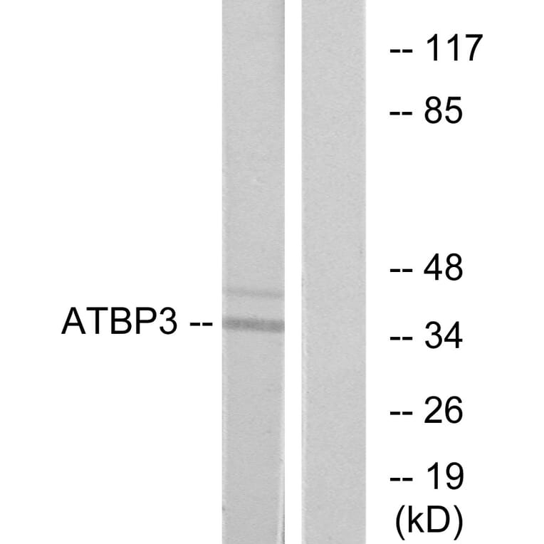 Western Blot - Anti-ATPBD3 Antibody (C11268) - Antibodies.com