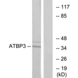 Western Blot - Anti-ATPBD3 Antibody (C11268) - Antibodies.com