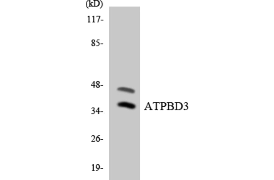 Western Blot - Anti-ATPBD3 Antibody (R12-2522) - Antibodies.com