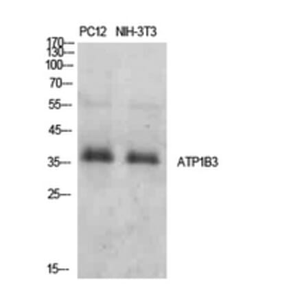 Western Blot - Anti-ATP1B3 Antibody (C30501) - Antibodies.com