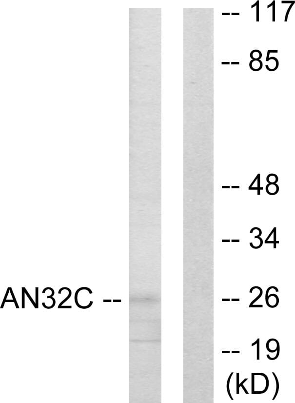 Western blot analysis of lysates from HUVEC cells using Anti-ANP32C Antibody. The right hand lane represents a negative control, where the antibody is blocked by the immunising peptide.