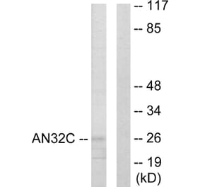 Western Blot - Anti-ANP32C Antibody (C10101) - Antibodies.com