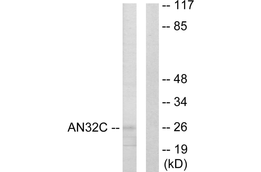 Western Blot - Anti-ANP32C Antibody (C10101) - Antibodies.com