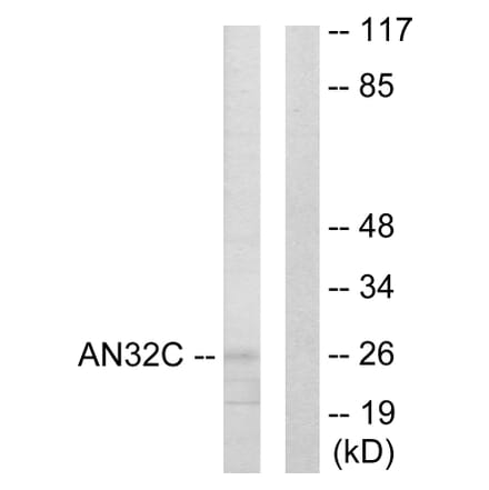 Western Blot - Anti-ANP32C Antibody (C10101) - Antibodies.com