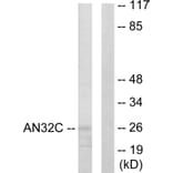 Western Blot - Anti-ANP32C Antibody (C10101) - Antibodies.com