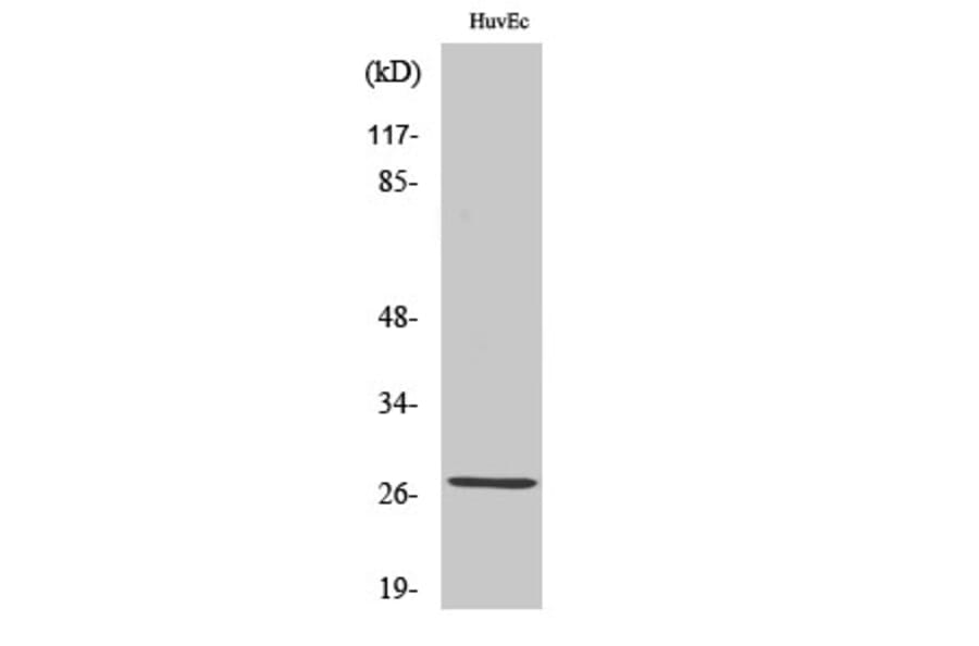 Western Blot - Anti-ANP32C Antibody (C10101) - Antibodies.com