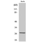 Western Blot - Anti-ANP32C Antibody (C10101) - Antibodies.com