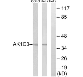 Western Blot - Anti-AKR1C3 Antibody (C14395) - Antibodies.com