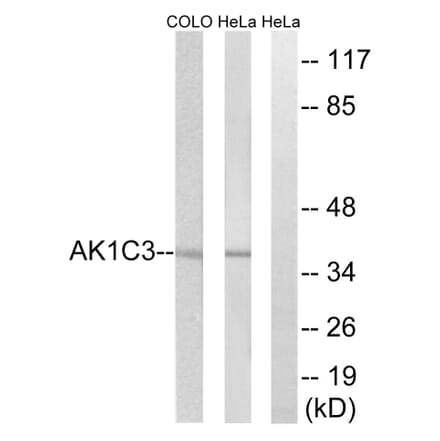 Western Blot - Anti-AKR1C3 Antibody (C14395) - Antibodies.com