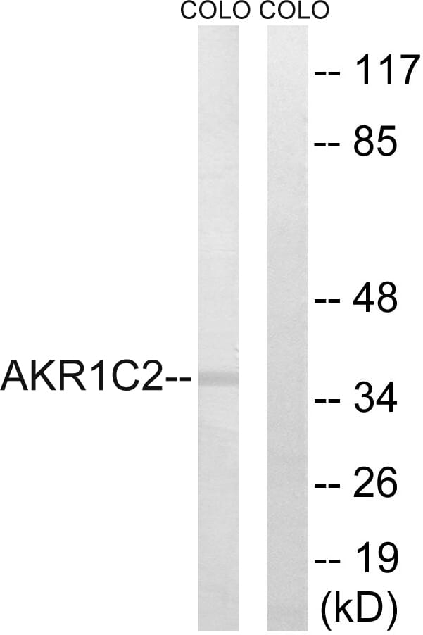 Western blot analysis of lysates from COLO cells using Anti-AKR1C2 Antibody. The right hand lane represents a negative control, where the antibody is blocked by the immunising peptide.