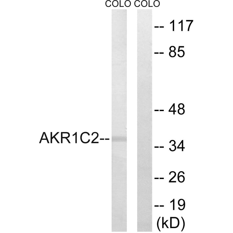 Western Blot - Anti-AKR1C2 Antibody (C14394) - Antibodies.com