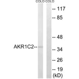 Western Blot - Anti-AKR1C2 Antibody (C14394) - Antibodies.com