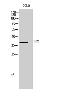 Western blot analysis of COLO cells using Anti-AKR1C2 Antibody.