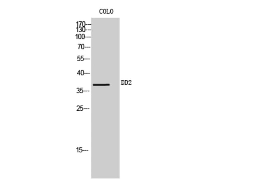 Western Blot - Anti-AKR1C2 Antibody (C14394) - Antibodies.com