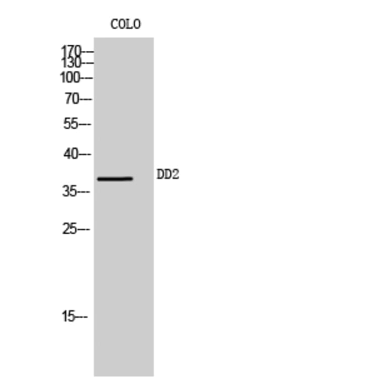 Western Blot - Anti-AKR1C2 Antibody (C14394) - Antibodies.com