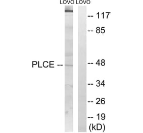 Western Blot - Anti-AGPAT5 Antibody (C14006) - Antibodies.com