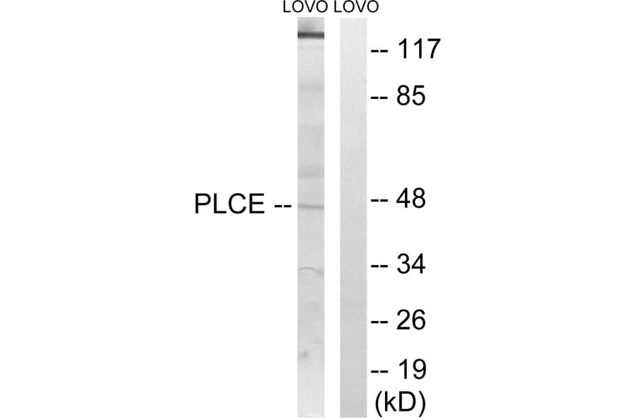 Western Blot - Anti-AGPAT5 Antibody (C14006) - Antibodies.com