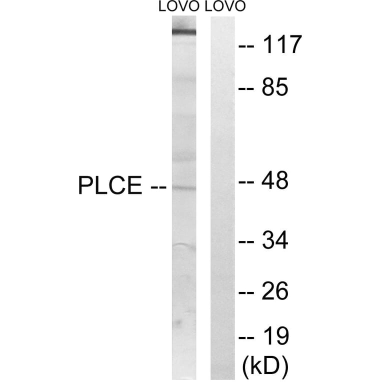 Western Blot - Anti-AGPAT5 Antibody (C14006) - Antibodies.com