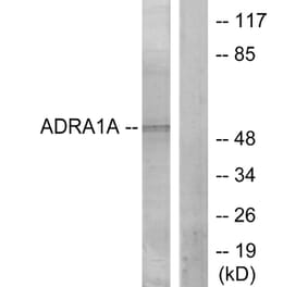 Western Blot - Anti-ADRA1A Antibody (C12028) - Antibodies.com