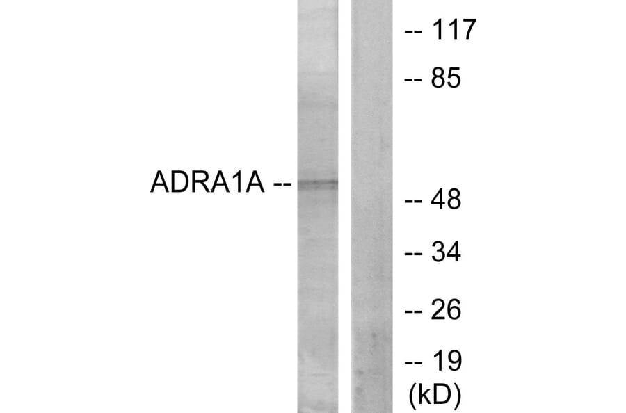 Western Blot - Anti-ADRA1A Antibody (C12028) - Antibodies.com
