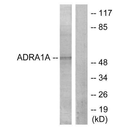 Western Blot - Anti-ADRA1A Antibody (C12028) - Antibodies.com