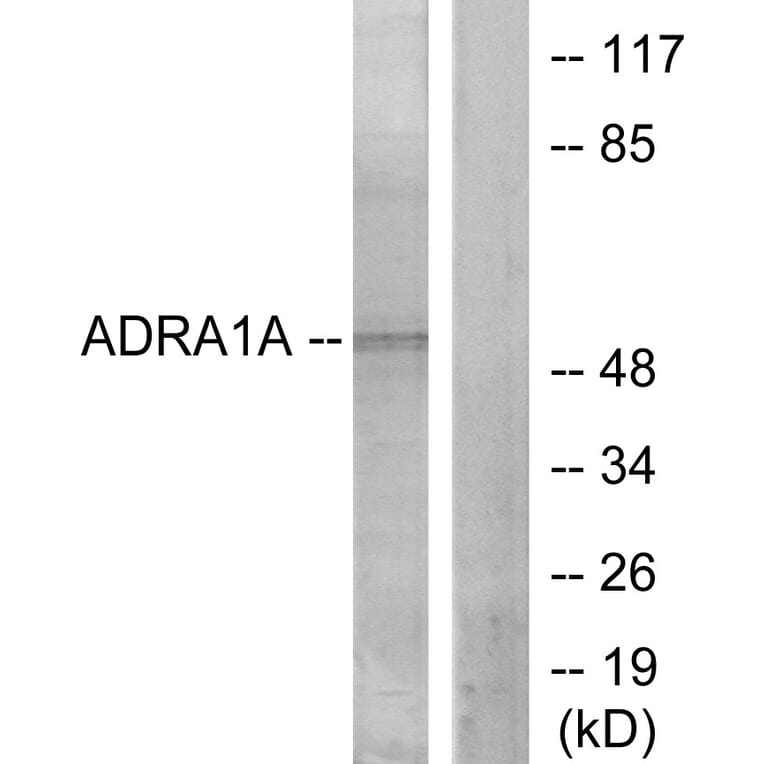 Western Blot - Anti-ADRA1A Antibody (C12028) - Antibodies.com