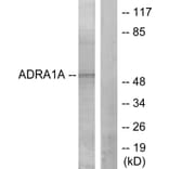 Western Blot - Anti-ADRA1A Antibody (C12028) - Antibodies.com