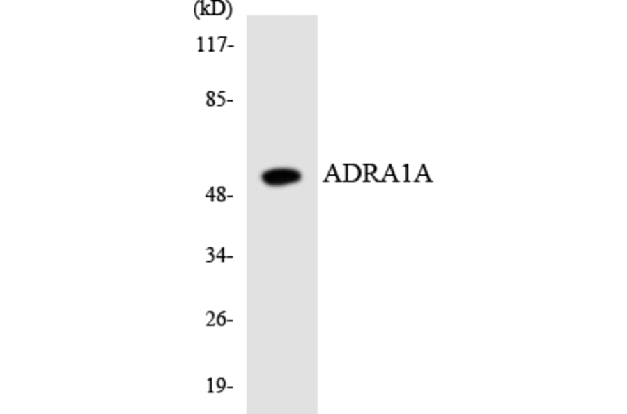 Western Blot - Anti-ADRA1A Antibody (R12-2456) - Antibodies.com