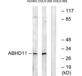 Western Blot - Anti-ABHD11 Antibody (C14208) - Antibodies.com