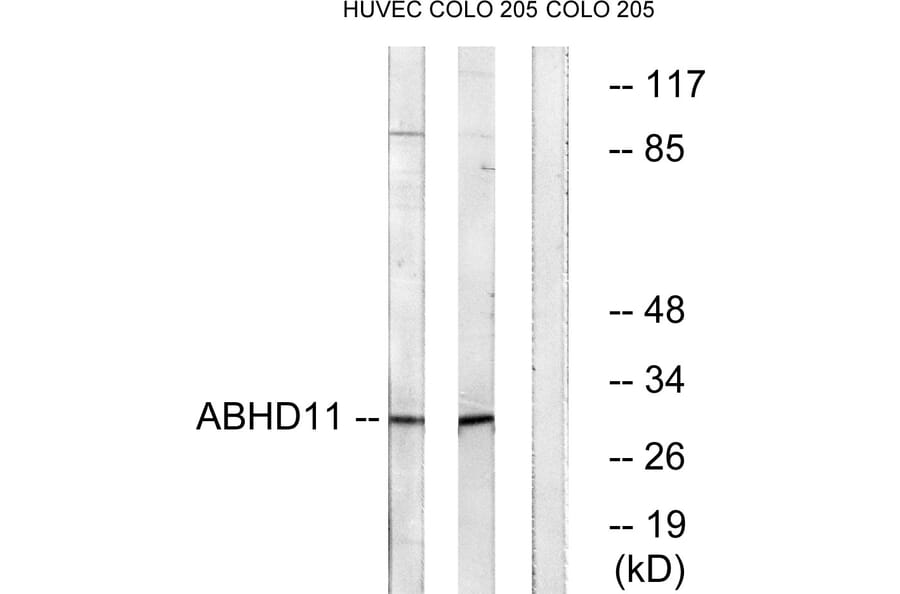 Western Blot - Anti-ABHD11 Antibody (C14208) - Antibodies.com