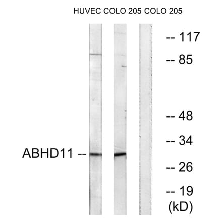 Western Blot - Anti-ABHD11 Antibody (C14208) - Antibodies.com