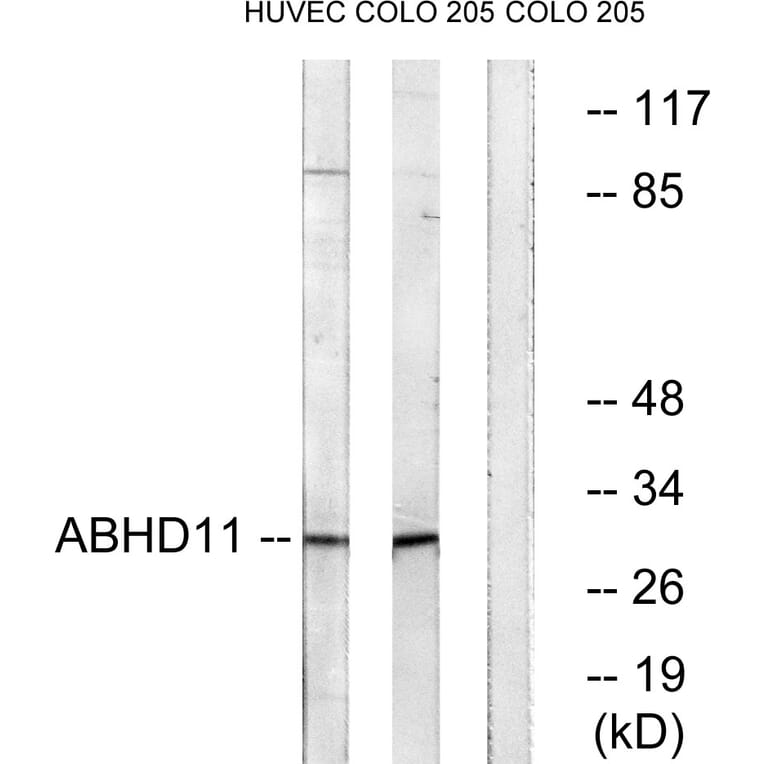 Western Blot - Anti-ABHD11 Antibody (C14208) - Antibodies.com