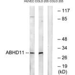 Western Blot - Anti-ABHD11 Antibody (C14208) - Antibodies.com