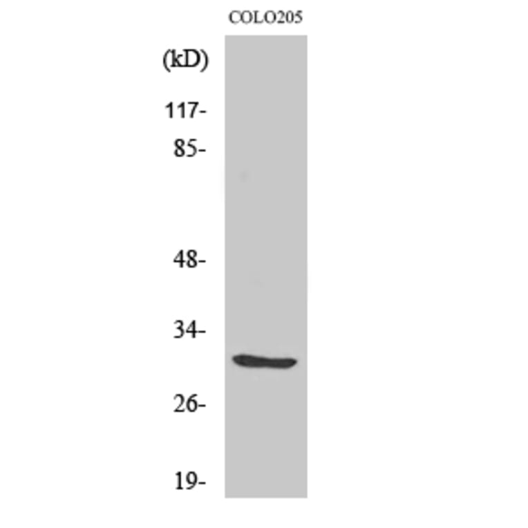 Western Blot - Anti-ABHD11 Antibody (C14208) - Antibodies.com