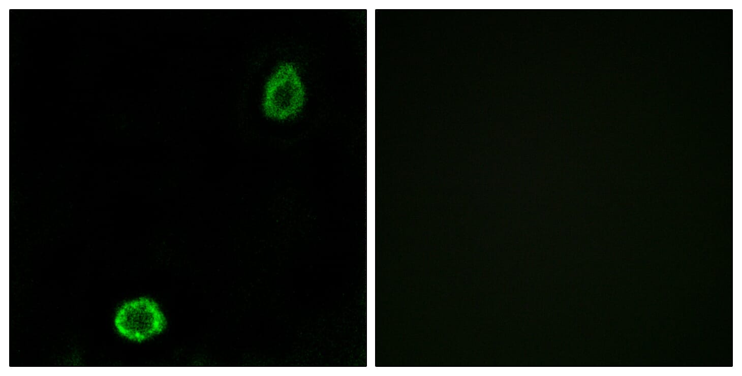 Immunofluorescence analysis of A549 cells using Anti-ABCA13 Antibody. The right hand panel represents a negative control, where the antibody was pre-incubated with the immunising peptide.