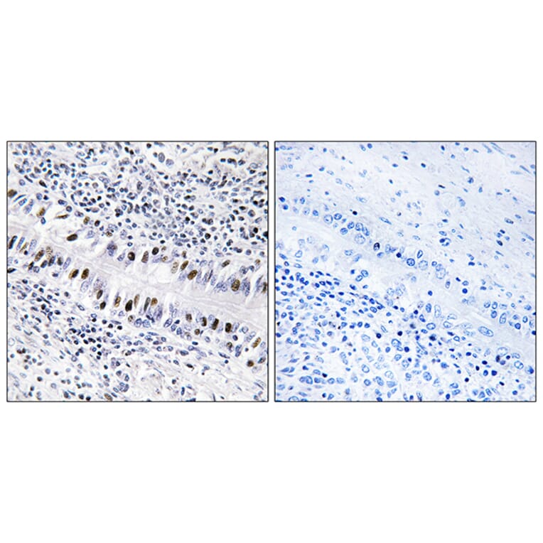 Immunohistochemistry - Anti-ZNF76 Antibody (C10573) - Antibodies.com