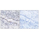 Immunohistochemistry - Anti-ZNF76 Antibody (C10573) - Antibodies.com