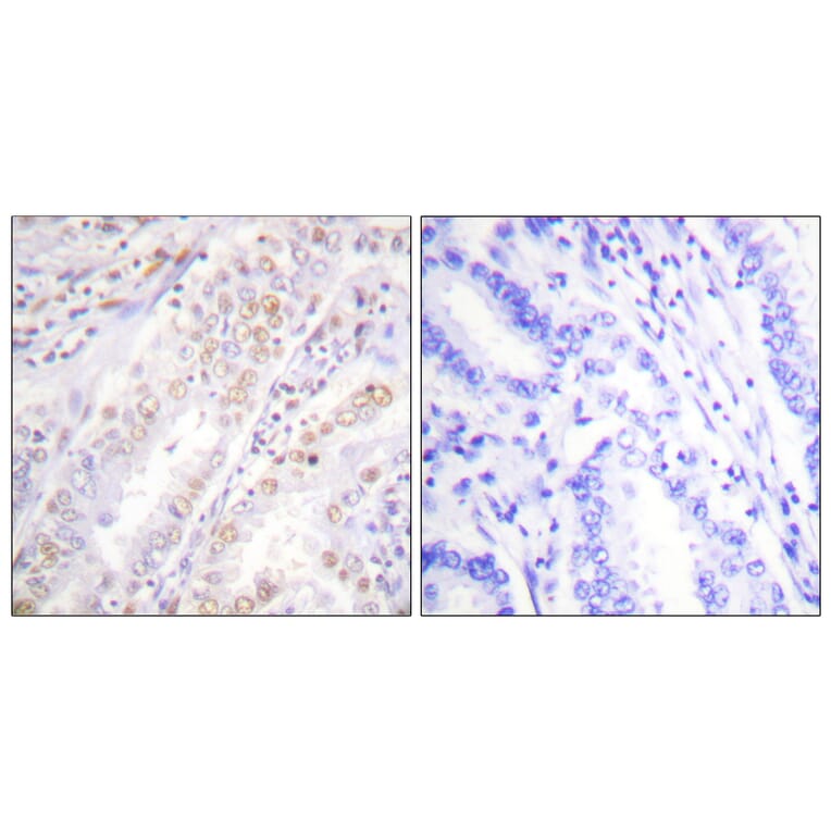 Immunohistochemistry - Anti-XRCC2 Antibody (C0396) - Antibodies.com