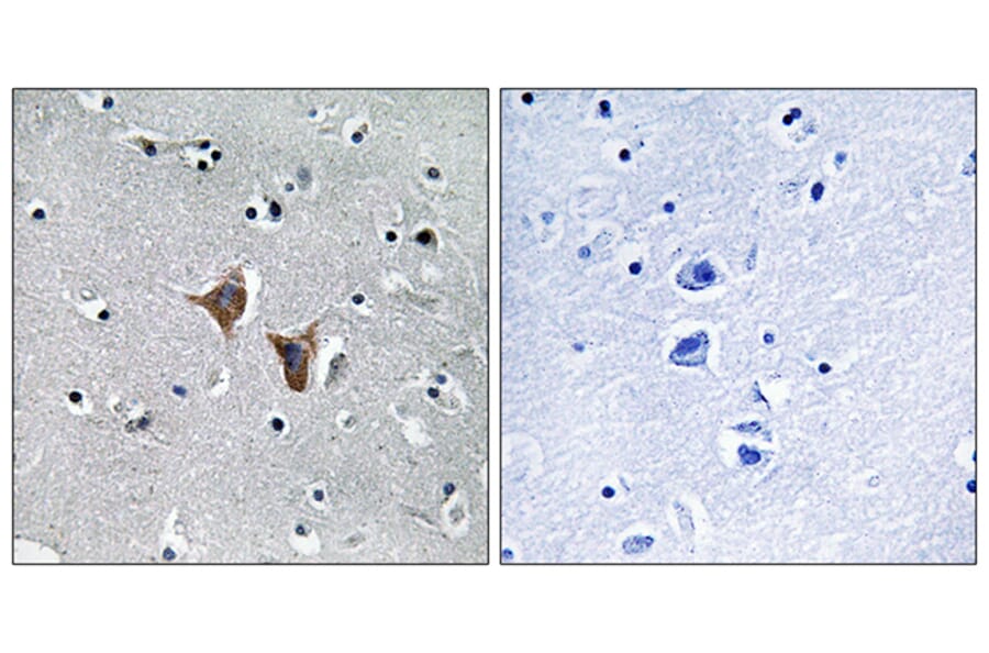Immunohistochemistry - Anti-WASF4 Antibody (C19562) - Antibodies.com