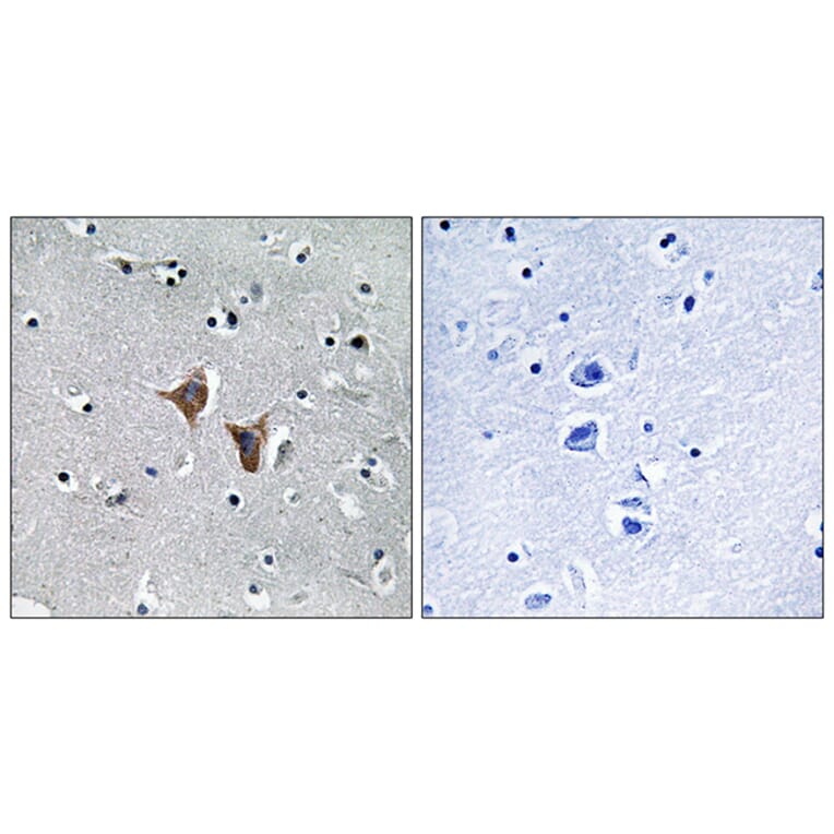 Immunohistochemistry - Anti-WASF4 Antibody (C19562) - Antibodies.com