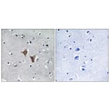 Immunohistochemistry - Anti-WASF4 Antibody (C19562) - Antibodies.com