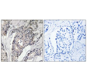 Immunohistochemistry - Anti-THBS4 Antibody (C19108) - Antibodies.com