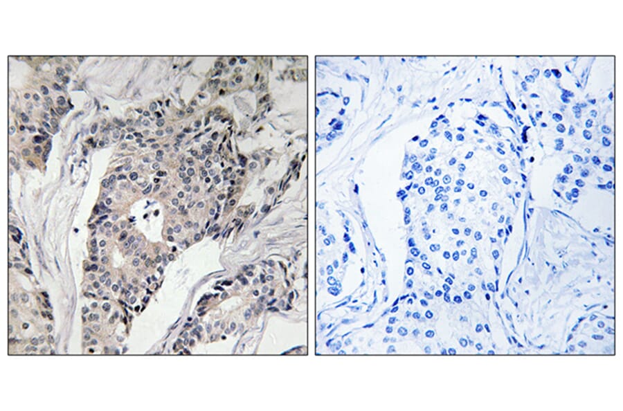 Immunohistochemistry - Anti-THBS4 Antibody (C19108) - Antibodies.com