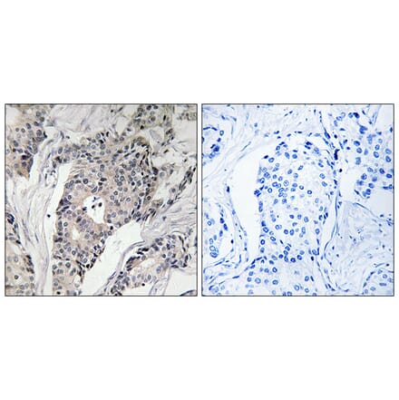 Immunohistochemistry - Anti-THBS4 Antibody (C19108) - Antibodies.com