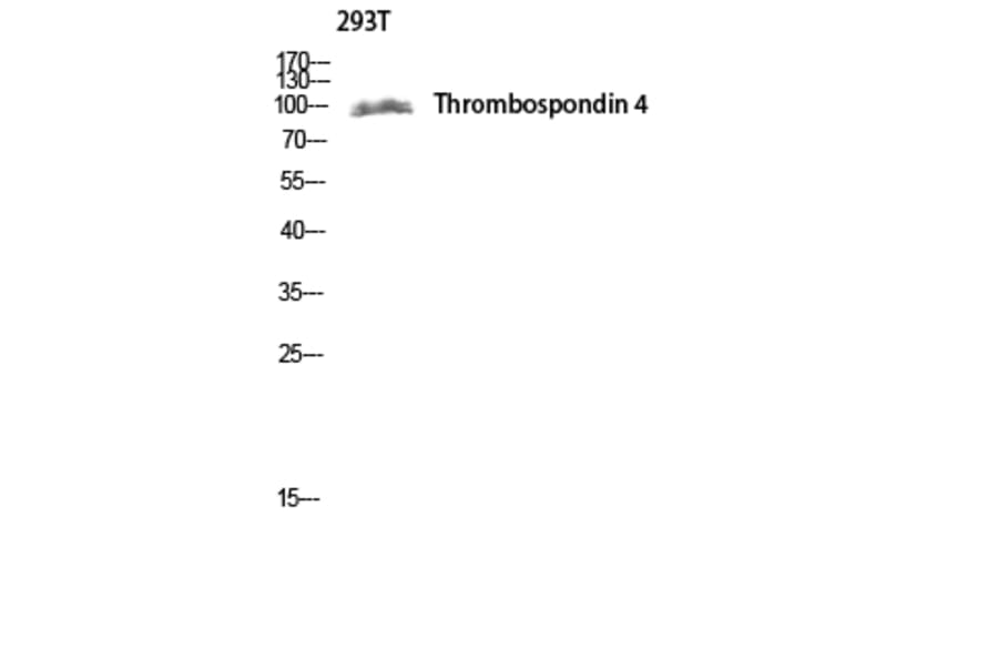 Western Blot - Anti-THBS4 Antibody (C19108) - Antibodies.com