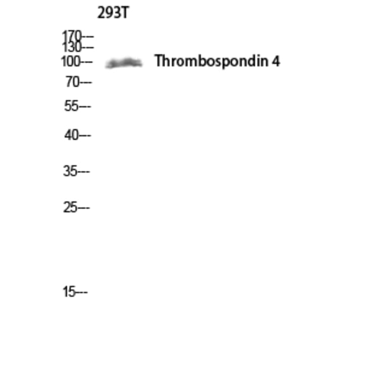 Western Blot - Anti-THBS4 Antibody (C19108) - Antibodies.com