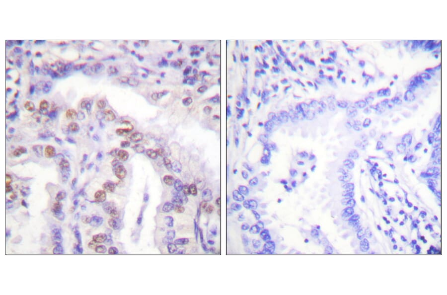 Immunohistochemistry - Anti-SENP6 Antibody (C0369) - Antibodies.com