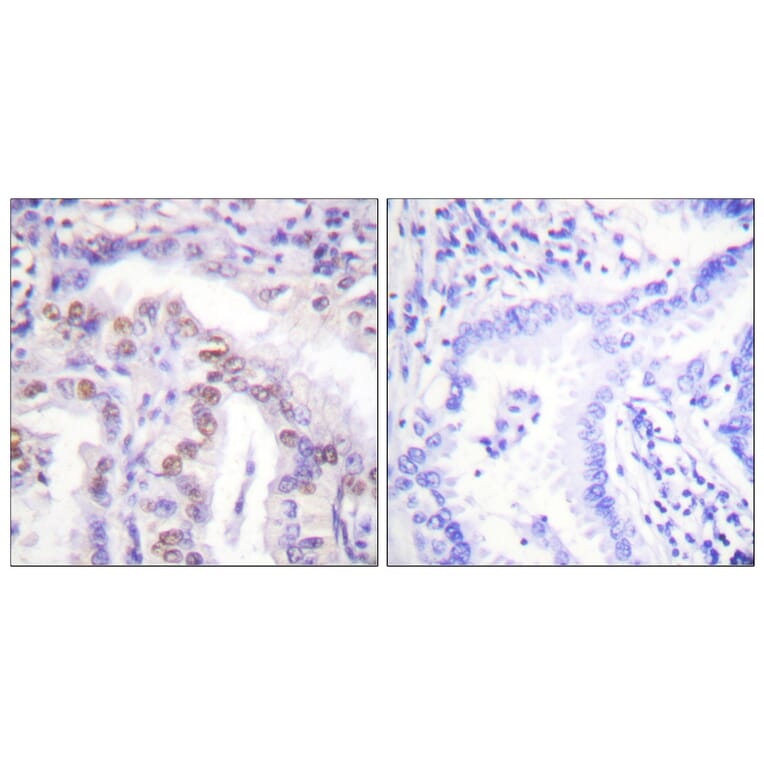 Immunohistochemistry - Anti-SENP6 Antibody (C0369) - Antibodies.com