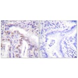Immunohistochemistry - Anti-SENP6 Antibody (C0369) - Antibodies.com